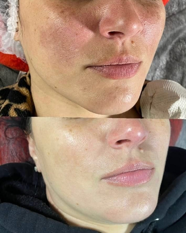 Трансформация 2