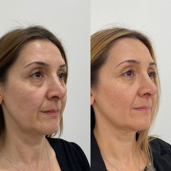 Трансформация 3